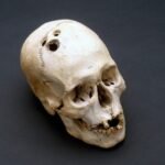 Anadolu’nun ilk (beyin) cerrahları