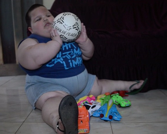 Prader-Willi Sendromu